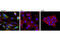 Platelet Derived Growth Factor Receptor Alpha antibody, 8871S, Cell Signaling Technology, Immunofluorescence image 