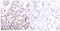 Activating Transcription Factor 2 antibody, PA5-38125, Invitrogen Antibodies, Immunohistochemistry frozen image 