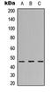 Ribosomal Protein L3 Like antibody, GTX56071, GeneTex, Western Blot image 