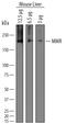 Mannose Receptor C-Type 1 antibody, AF2535, R&D Systems, Western Blot image 