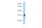 Transmembrane And Ubiquitin Like Domain Containing 2 antibody, A16098, Boster Biological Technology, Western Blot image 