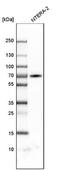 Zinc Finger Protein 384 antibody, NBP1-86675, Novus Biologicals, Western Blot image 