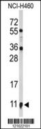 S100 Calcium Binding Protein A10 antibody, MBS9211232, MyBioSource, Western Blot image 