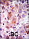G Protein-Coupled Receptor Kinase 2 antibody, 62-582, ProSci, Immunohistochemistry paraffin image 
