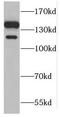 GTF2I Repeat Domain Containing 1 antibody, FNab03716, FineTest, Western Blot image 