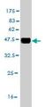 Fibroblast Growth Factor 21 antibody, ab57059, Abcam, Western Blot image 