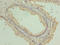 Component Of Oligomeric Golgi Complex 3 antibody, LS-C399656, Lifespan Biosciences, Immunohistochemistry paraffin image 