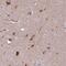 Solute Carrier Family 5 Member 7 antibody, FNab01700, FineTest, Immunohistochemistry frozen image 