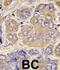 Heat Shock Protein Family B (Small) Member 1 antibody, abx033222, Abbexa, Immunohistochemistry frozen image 