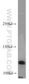 Phospholipase D1 antibody, 18355-1-AP, Proteintech Group, Western Blot image 