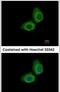 Ubiquitin Conjugating Enzyme E2 O antibody, PA5-31429, Invitrogen Antibodies, Immunofluorescence image 