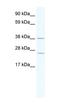 Twinkle protein, mitochondrial antibody, orb324645, Biorbyt, Western Blot image 