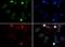 RAD51 Paralog D antibody, GTX23638, GeneTex, Immunofluorescence image 