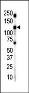 Insulin Receptor Related Receptor antibody, PA5-14690, Invitrogen Antibodies, Western Blot image 