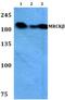 CDC42 Binding Protein Kinase Beta antibody, PA5-36291, Invitrogen Antibodies, Western Blot image 