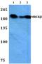 Serine/threonine-protein kinase MRCK beta antibody, PA5-36291, Invitrogen Antibodies, Western Blot image 