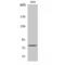 EPS8 Like 1 antibody, LS-C383383, Lifespan Biosciences, Western Blot image 