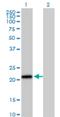 Integrin cytoplasmic domain-associated protein 1 antibody, H00009270-M09, Novus Biologicals, Western Blot image 