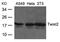Twist Family BHLH Transcription Factor 2 antibody, orb69642, Biorbyt, Immunohistochemistry paraffin image 
