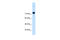 Actinin Alpha 4 antibody, 29-713, ProSci, Western Blot image 