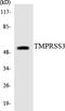 Transmembrane Serine Protease 3 antibody, LS-C200794, Lifespan Biosciences, Western Blot image 