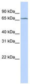 TRNA Methyltransferase 5 antibody, TA346865, Origene, Western Blot image 