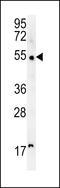 Scavenger Receptor Class A Member 5 antibody, LS-C162888, Lifespan Biosciences, Western Blot image 