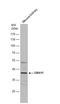 G Protein Subunit Alpha 11 antibody, NBP2-16697, Novus Biologicals, Western Blot image 