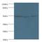 Origin Recognition Complex Subunit 4 antibody, LS-C376247, Lifespan Biosciences, Western Blot image 