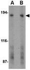 Adhesion G Protein-Coupled Receptor A2 antibody, GTX31326, GeneTex, Western Blot image 