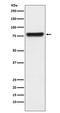 Kallikrein B1 antibody, M04995, Boster Biological Technology, Western Blot image 