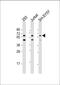 Hexosaminidase D antibody, 61-319, ProSci, Western Blot image 