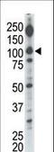 Diacylglycerol Kinase Iota antibody, LS-C101234, Lifespan Biosciences, Western Blot image 