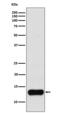 Cystatin A antibody, M03914, Boster Biological Technology, Western Blot image 