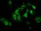 Protein Phosphatase Methylesterase 1 antibody, MA5-25026, Invitrogen Antibodies, Immunocytochemistry image 