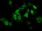 Protein Phosphatase Methylesterase 1 antibody, MA5-25026, Invitrogen Antibodies, Immunocytochemistry image 