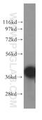 RAD51 Associated Protein 1 antibody, 11255-1-AP, Proteintech Group, Western Blot image 