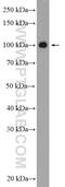 SIX Homeobox 5 antibody, 22938-1-AP, Proteintech Group, Western Blot image 