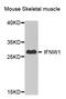 Interferon Omega 1 antibody, A8125, ABclonal Technology, Western Blot image 