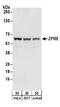 Zinc Finger Protein 622 antibody, A304-077A, Bethyl Labs, Western Blot image 