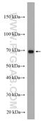 Interleukin 2 Receptor Subunit Gamma antibody, 27377-1-AP, Proteintech Group, Western Blot image 