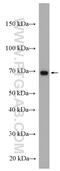 Cytokine receptor common subunit gamma antibody, 27377-1-AP, Proteintech Group, Western Blot image 