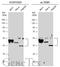 Keratin 10 antibody, GTX113221, GeneTex, Western Blot image 