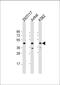 PHD Finger Protein 6 antibody, 61-202, ProSci, Western Blot image 