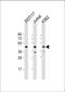 PHD finger protein 6 antibody, 61-202, ProSci, Western Blot image 