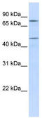 ERCC Excision Repair 8, CSA Ubiquitin Ligase Complex Subunit antibody, TA344522, Origene, Western Blot image 