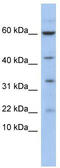 LMO2 antibody, TA330149, Origene, Western Blot image 