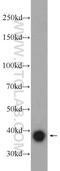 Sirtuin 2 antibody, 19655-1-AP, Proteintech Group, Western Blot image 