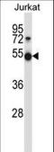 Pim-1 Proto-Oncogene, Serine/Threonine Kinase antibody, LS-C164530, Lifespan Biosciences, Western Blot image 