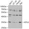 KIT Ligand antibody, A5672, ABclonal Technology, Western Blot image 